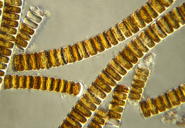 Brown algae diatoms viewed under a microscope