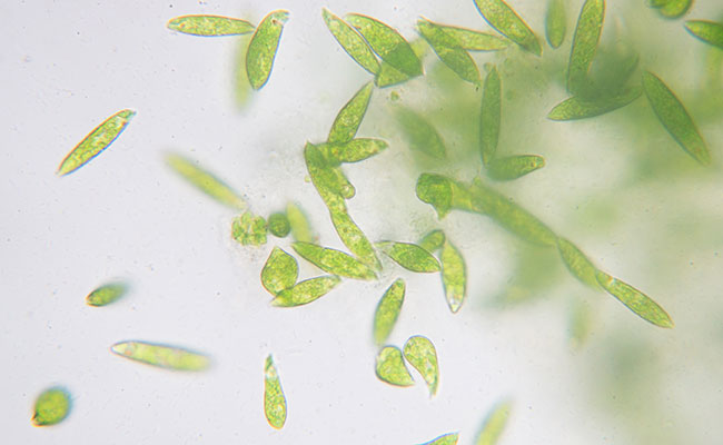 Green aquarium water under microscope